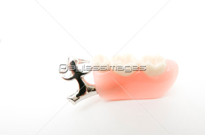 部分入歯の模型