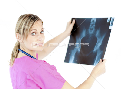 Serious young surgeon holding a x-ray