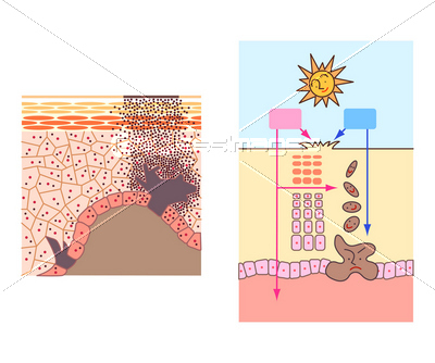 肌 皮膚 断面図 イラスト ストックフォトの定額制ペイレスイメージズ