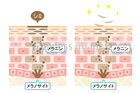 ターンオーバー 肌の断面図 ストックフォトの定額制ペイレスイメージズ