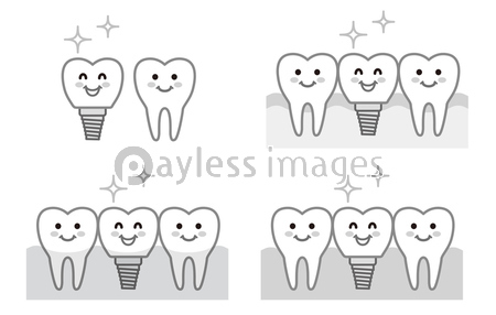 歯 インプラント モノクロ イラスト ストックフォトの定額制ペイレスイメージズ