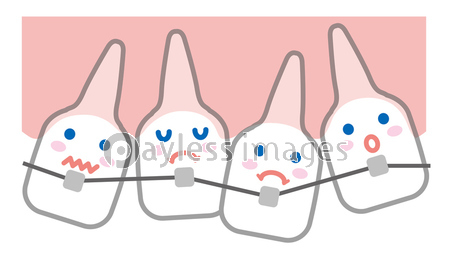 歯並び 歯列矯正 イラスト ストックフォトの定額制ペイレスイメージズ