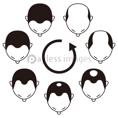 薄毛の進行 男性 ハゲ 商用利用可能な写真素材 イラスト素材ならストックフォトの定額制ペイレスイメージズ