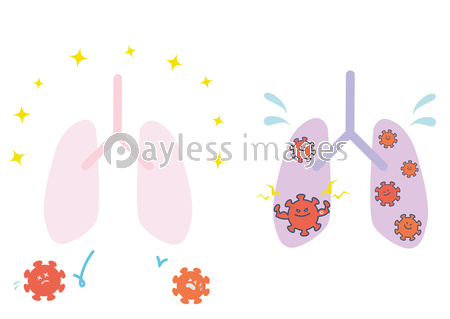 健康な肺 ウイルスに感染した肺 イラストセット ストックフォトの定額制ペイレスイメージズ