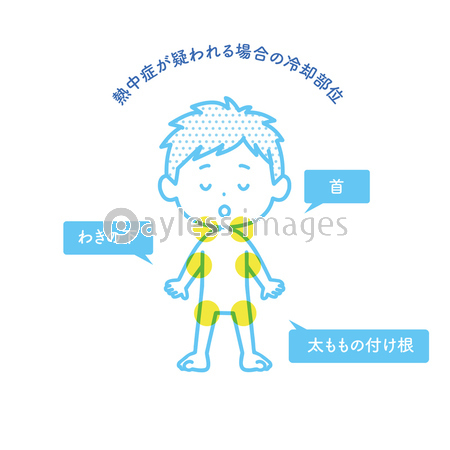 熱中症が疑われる時の冷却部位のイラスト 商用利用可能な写真素材 イラスト素材ならストックフォトの定額制ペイレスイメージズ