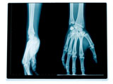 Hand+and+wrist+radiography