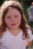 Freckled+Little+Girl